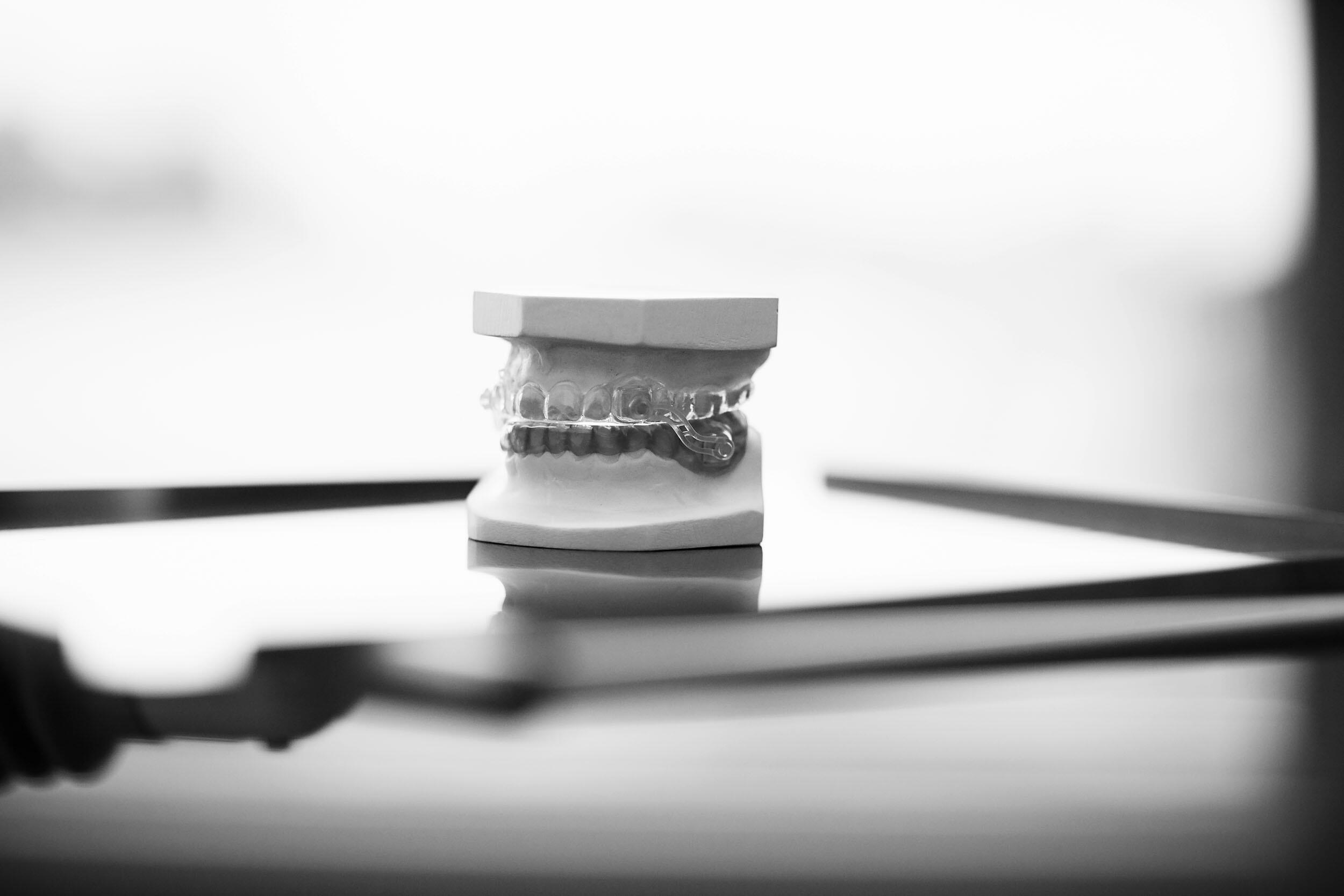 Bild zeigt ein Gipsmodell von einem Gebiss mit Zahnspange